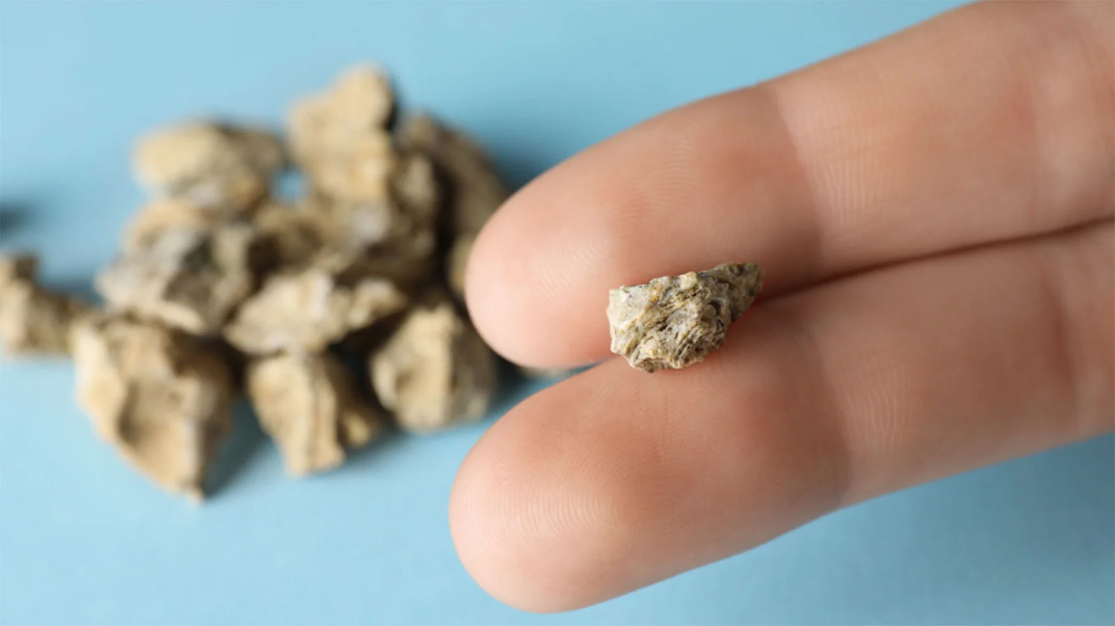 do cigarettes cause kidney stones Does Cannabis Cause Kidney Stones or Help Relieve Symptoms?